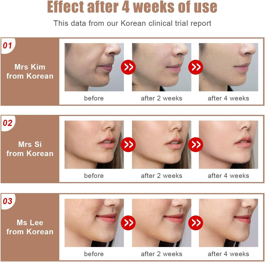 Microcurrent Face Lifting Massager for Skin Rejuvenation craftedpersona.co